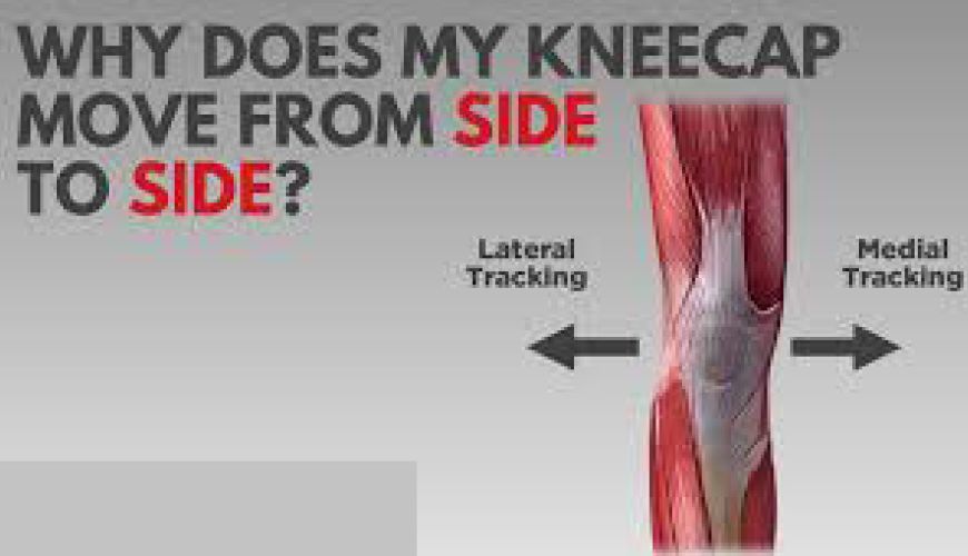 knee instability 